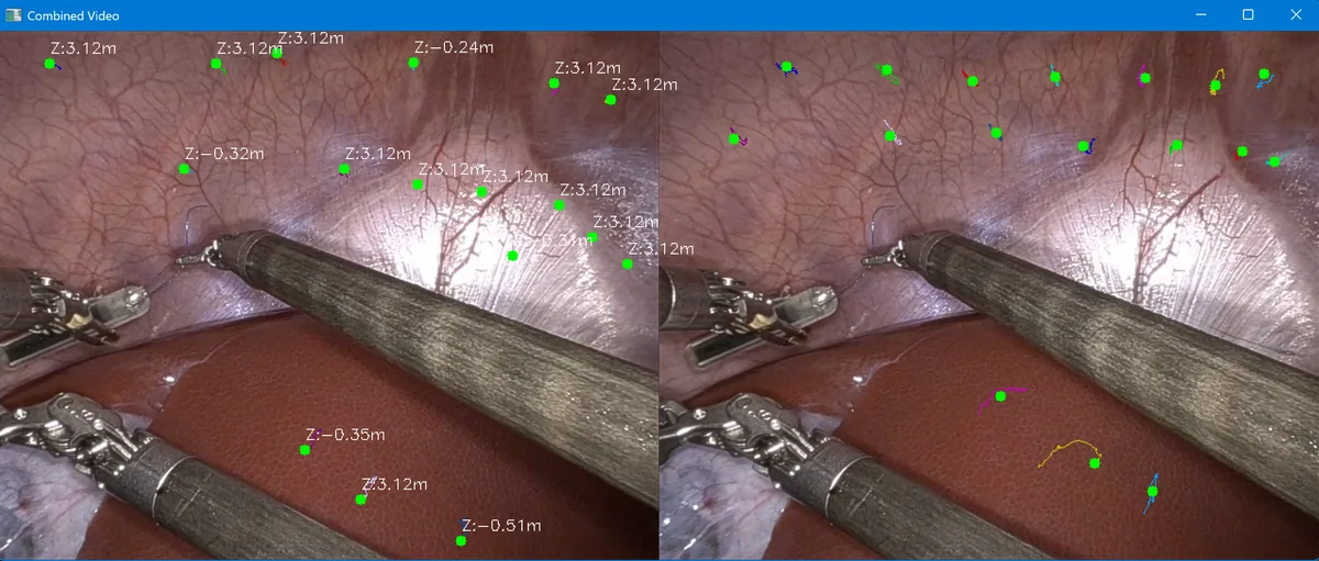 Surgical instrument and tissue tracking views with detected features.
